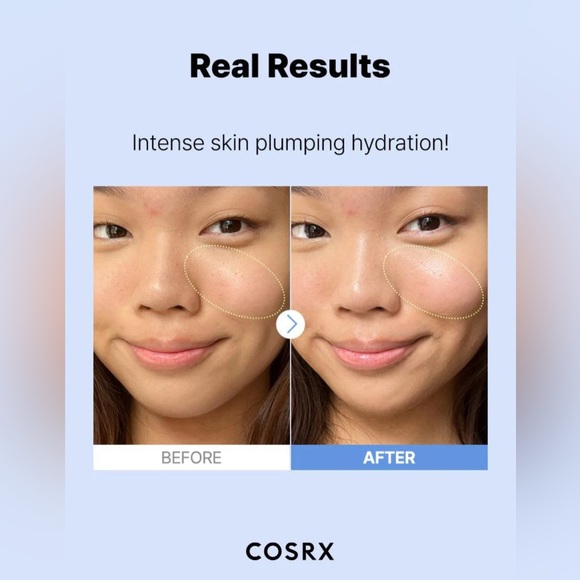 NEW - COSRX The Hyaluronic Acid 3 Serum - Picture 7 of 12